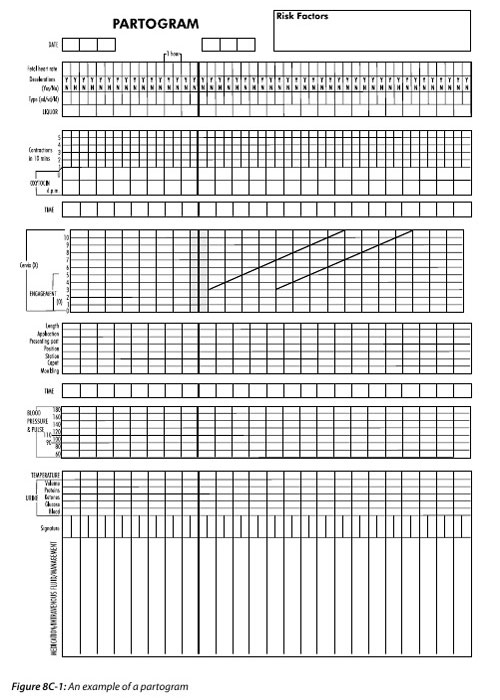 An unfilled partogram